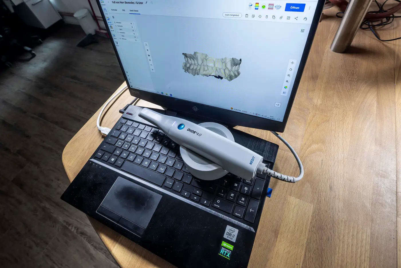Intraoralscanner mit digitaler Abformung auf dem Laptop